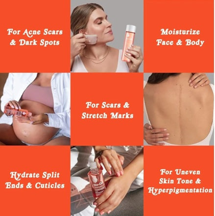 Bio-Oil Body Skincare Oil 200ml
