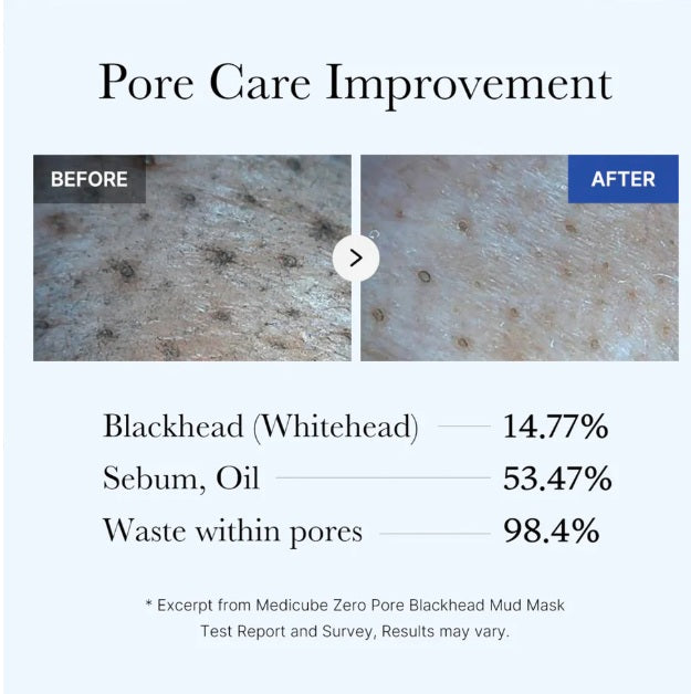 Medicube Zero Pore Blackhead Mud Mask