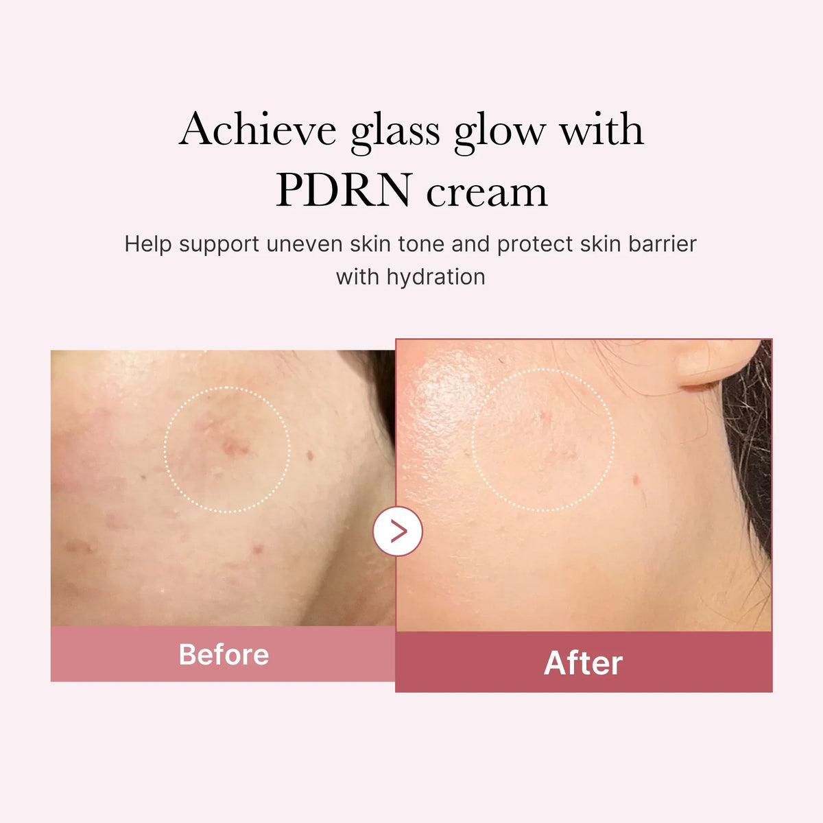 Medicube PDRN Pink hyaluronic Moisturizing Cream