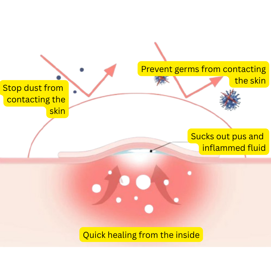 Acne Patch