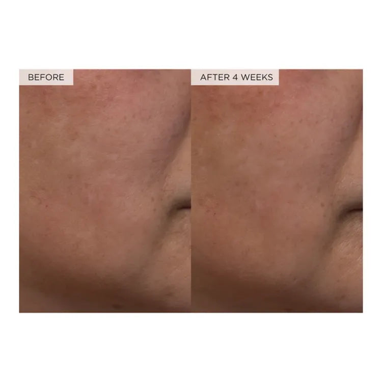 Glow Recipe Watermelon Glow PHA + BHA Pore-Tight Toner 150ml